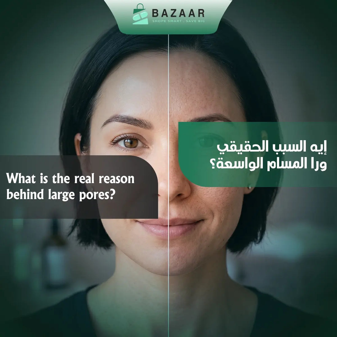 The Real Reason Behind Enlarged Pores