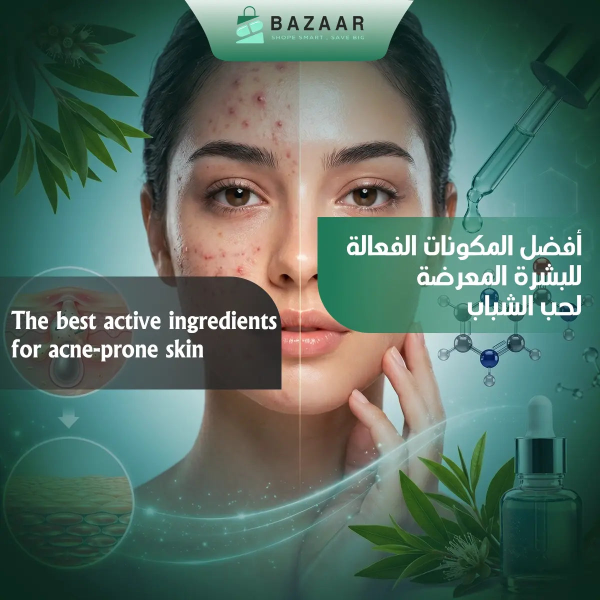 Best Active Ingredients for Acne-Prone Skin