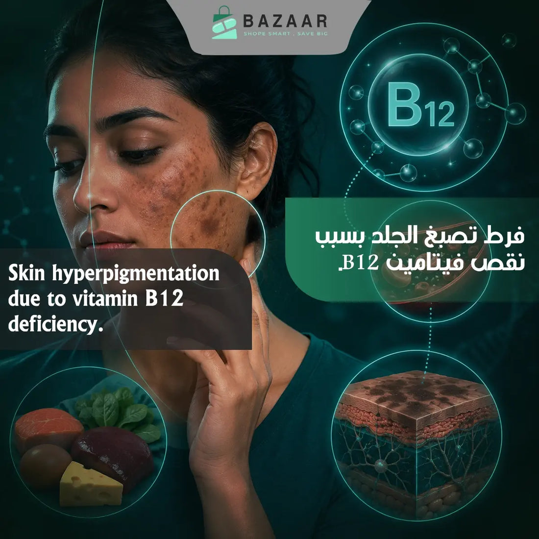 Can Vitamin B12 Deficiency Cause Skin Hyperpigmentation?