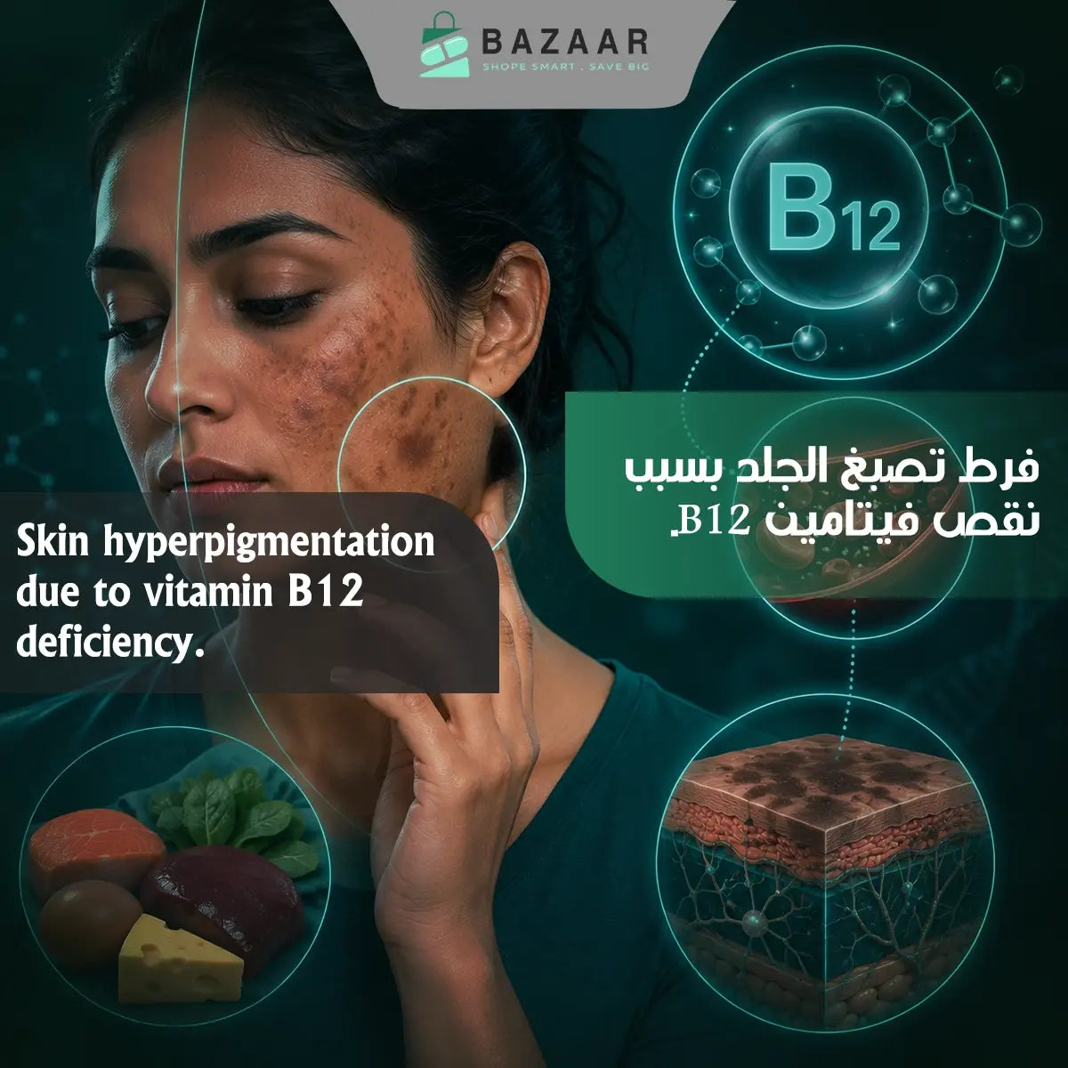 Can Vitamin B12 Deficiency Cause Skin Hyperpigmentation?