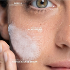 La Roche-Posay Effaclar Micropeeling Cleanser 200 ml