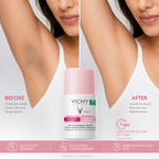 Vichy Deodorant Anti-Dark Spots Roll-On 50ml