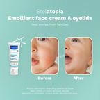 MUSTELA Stelatopia Cream 40 ML