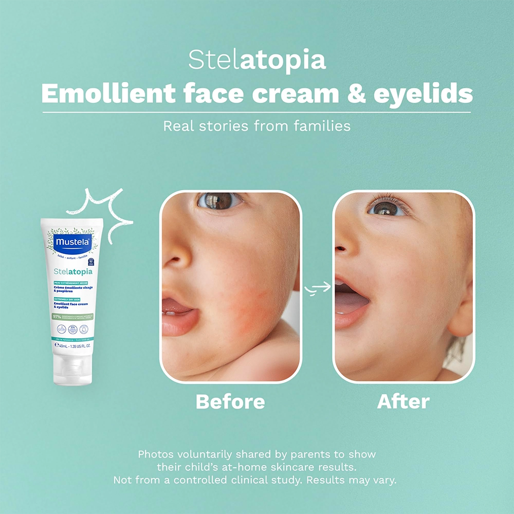 MUSTELA Stelatopia Cream 40 ML