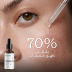 WHITEXPERT Night Repair Serum 30ML